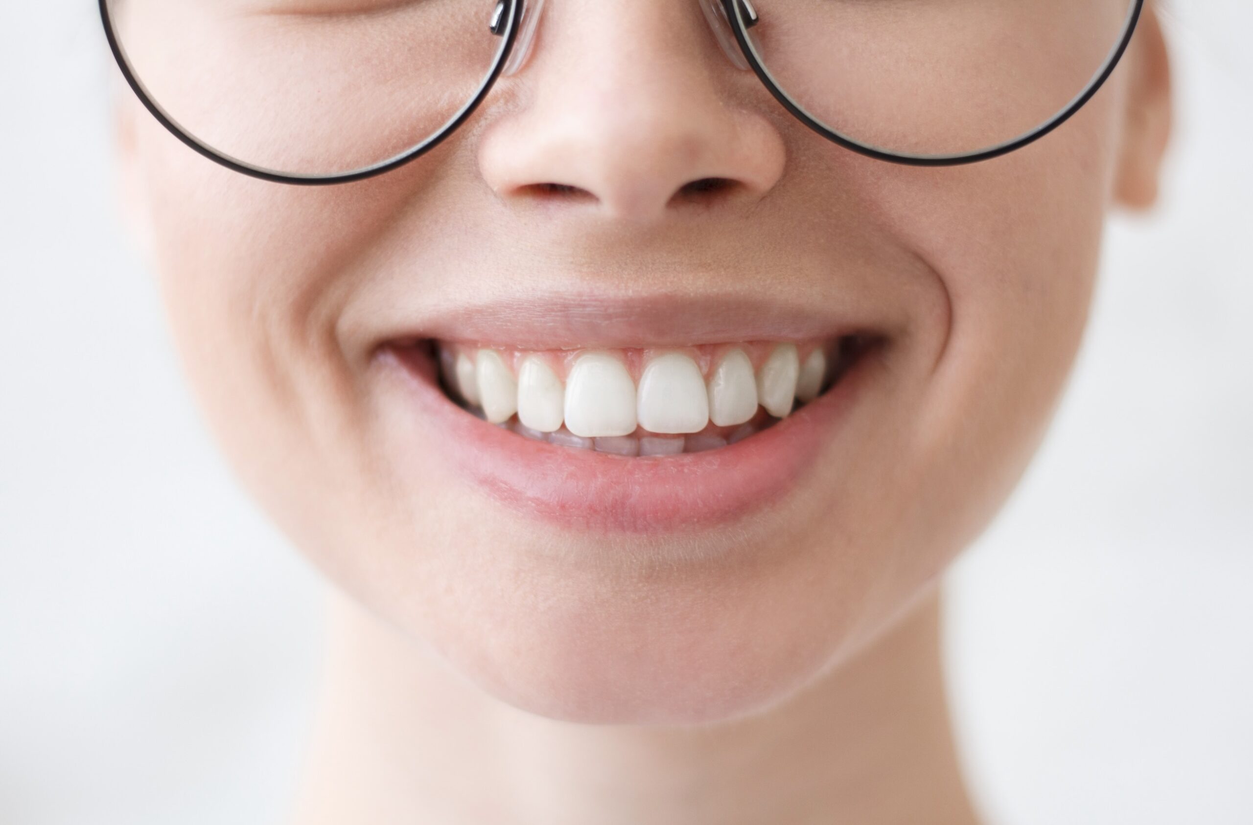 sbiancamento denti come funziona
